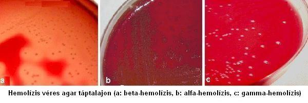 - haemolízis véres agaron: -haemolízis: részleges hemoglobin lebontás