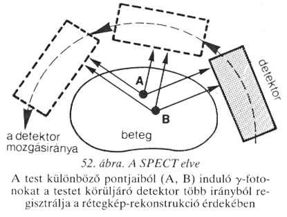 A SPECT