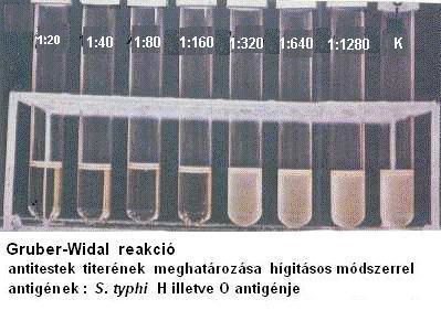 Gruber-Widal