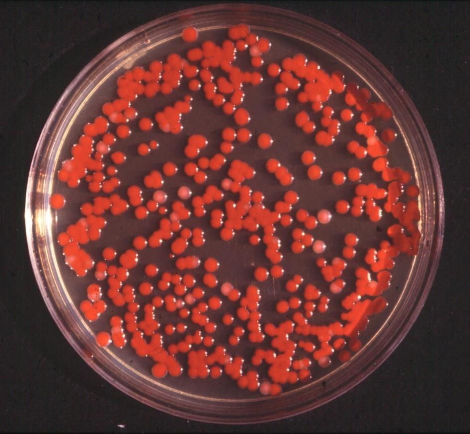 Serratia genus Serratia marcescens: opportunista patogén