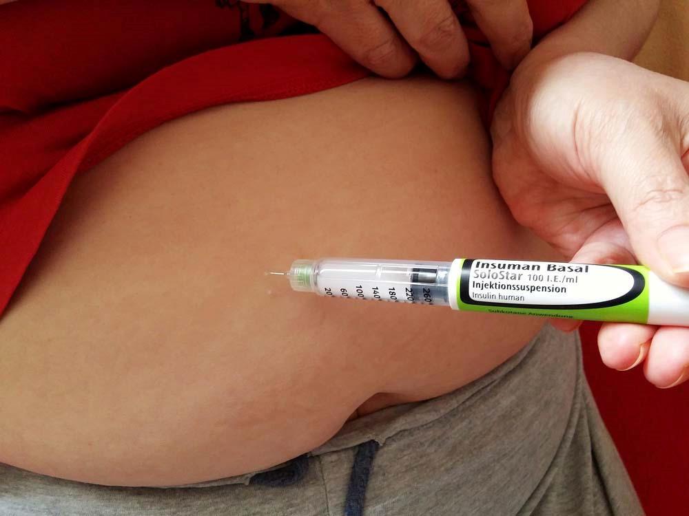 A GLUKOMÉTEREK MEGJELENÉSÉVEL