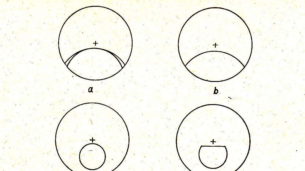 Bifokális és trifokális szemüveglencsék I/a, b, c, d: egy lencséből készült becsiszolt közeli
