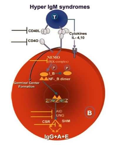 X-kromoszómához kapcsolt hyper-igm-szindróma CD40- Ligandum képződés zavara, Nincs izotípusváltás