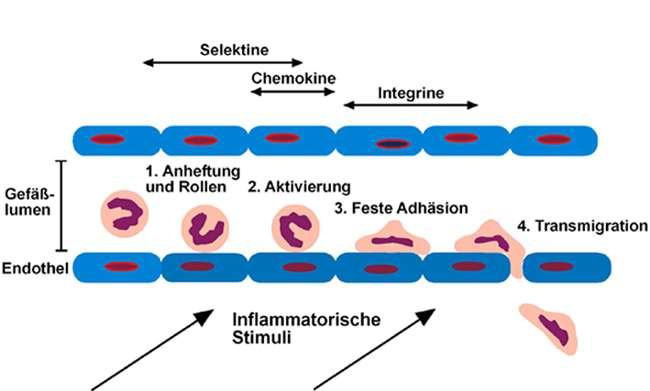 A neutrofil granulociták sejtmembrán defektusa: adhézió és kemotaxis LAD (Leukocyte