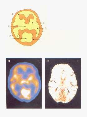 Az agy részei 1. Látókéreg 2. Occipitalis lebeny 3. Thalamus 4.