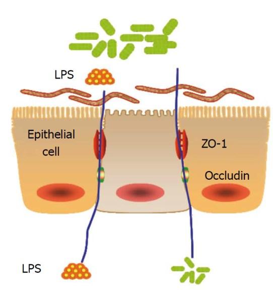 Az intestinális microbiota és a T2DM feltételezett kapcsolata Magas zsír/fruktóz tartalmú diéta Az intestinális microbiota megváltozása Bél permeabilitás Epithel sejt Akkernamansia muciniphila