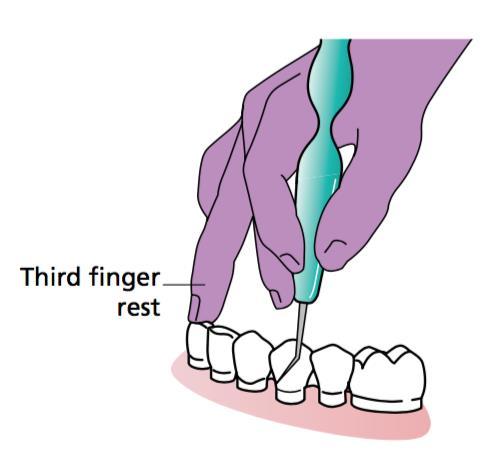 Extra és intraorális megtámasztás (maxilla) Clinical periodontology and