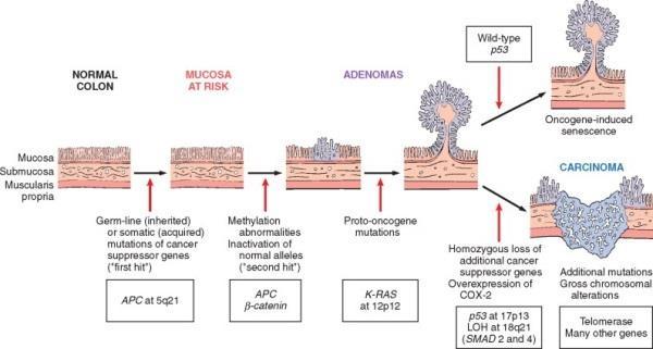 Soklépcsős karcinogenezis: vastagbélrák epidemiológia, kísérletes adatok: a karcinogenezis soklépcsős folyamat a tumorok (emlő, CRC) teljes genom-szekvenálása: átlagban 90 mutáns gén