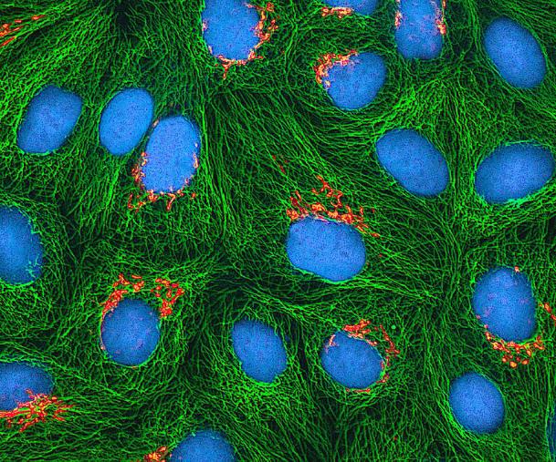 apparatus (orange), microtubules (green) and