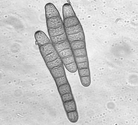 ábra: A ipolaris sorokiniana (A) és a Drechslera dactylidis () konídiumai ( 500) A Figure 6: Conidien of ipolaris sorokiniana (A) and Drechslera dactylidis () ( 500) A keszthelyi és ausztriai