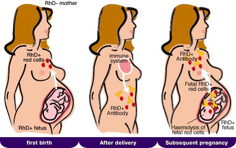 Anti-D iimmunglobulin készítmény Rh /D/ izoimm. megelőzése (az Rh/D/ izoimm-ra veszélyeztett egyén: az Rh /D/ neg. + Rh /D/ poz vvs idegen ag imm. r. akt. anti-d at ) imm: foetomat.