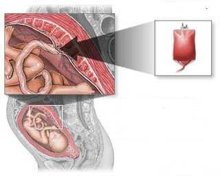 13. A TRANSZFÚZIÓ NEONATOLÓGIAI VONATKOZÁSAI ÚJSZÜLÖTTKORI HEMOLITIKUS BETEGSÉG((ÚHB)