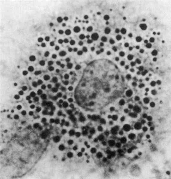 A macrophagok (histiocyták) a monocyták származékai. Nagyobb méretű idegen testek körül összeolvadva többmagvú sejteket ún. idegent,est,-óriássejt,eket alkotnak.