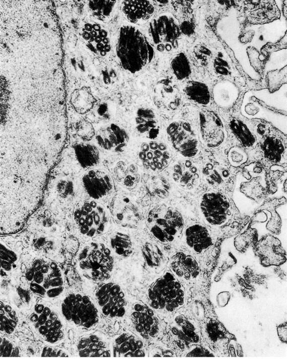 Hízósejtek (heparinocytt,ák rmast,rcells) Változó számban főleg apróbb erek szomszédságában találhatók. Ovális vagy néha lekerekített szegletű, laposabb, egymagvú sejtek, amelyek plasmája kb.