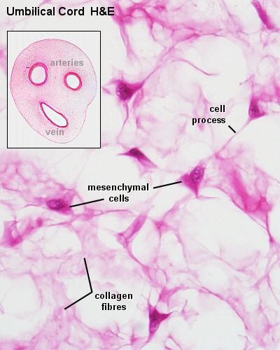 Kocsoncás kötőszövet: Elágazó nyúlványos sejtek Sejtközötti állomány gélszerű, kollagén rostokat is tartalmaz.