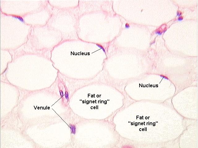 Zsírszövet: Fehér zsírszövet: nagy internális zsírcsepp, vékony citoplazma réteg a sejthártyához tapadva, lapos mag sejt szélén.