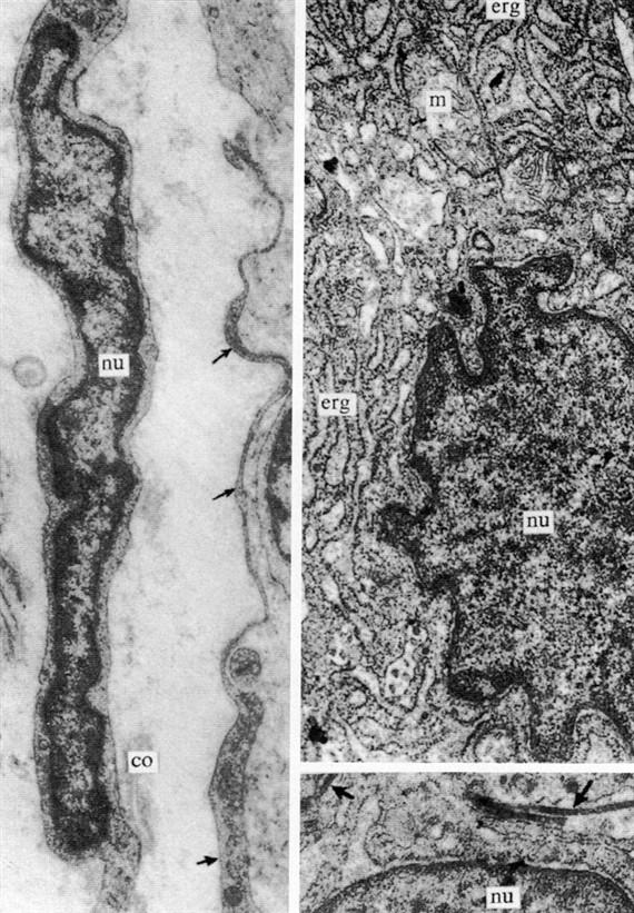 Fibroccta és aktív fbroblast elektronmikroszkópos képe Bal: lapjára merőlegesen metszett fibrocyta maggal (nu) és szerkezetszegény plasmával (nyilak). A sejt közti állományban kevés kollagénrost (co).