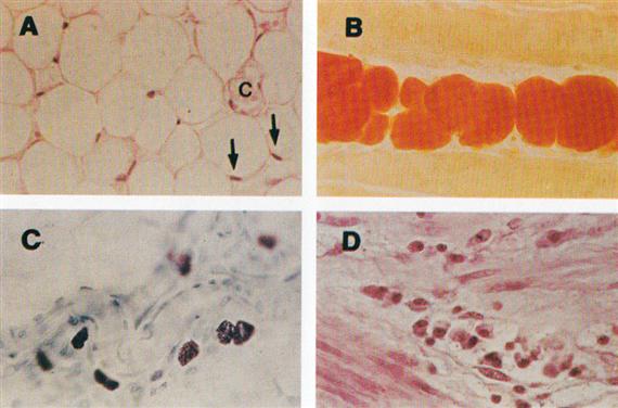 Zsírsejtek (steatocyták, vagy adipocyták): Nagy, gömb alakú zsírcseppet tartalmaznak, amelyet a sejtplazma keskeny csíkkal vesz körül. Megvastagodott részében van a sejtmag.