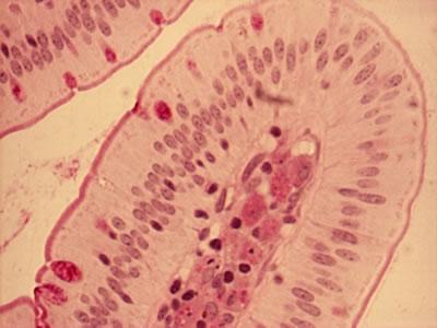 aszimmetrikusan elhelyezkedő sejtmag Makrofág a rózsaszín