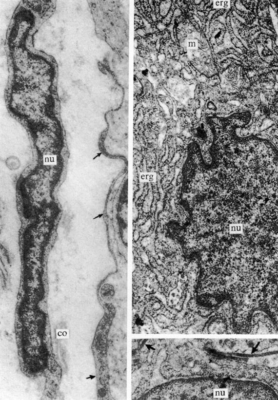 Fibrocyta és aktív fibroblast elektron mikroszkópos képe (Salamon és Hámori anyagából). Bal: lapjára merőlegesen metszett fibrocyta maggal (nu) és szerkezet szegény plazmával (nyilak).