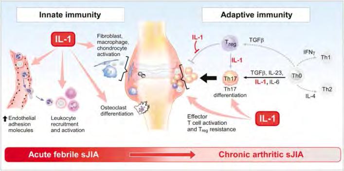 Az akut és krónikus SJIA patomechanizmusa 1. The biphasic model of systemic juvenile idiopathic arthritis (sjia).