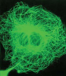 rendszer Egyedi mikrotubulusok