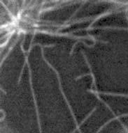 keratinocita Mikrotubulus