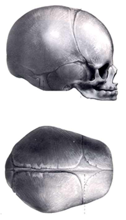 Csontrendszer 1. Fejváz agykoponya arckoponya 2. Törzsváz gerincoszlop mellkas bordák szegycsont 3.