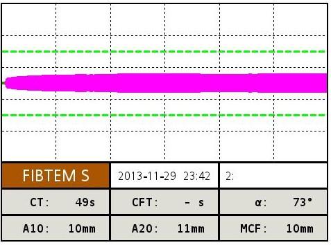 1g 10 EEvvt 10/4 FFP, 2000 PPC 75 E E 5vvt vvt vvt