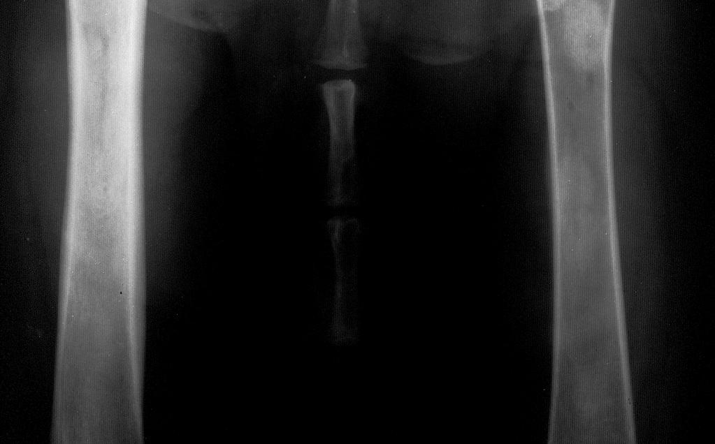 Hipertrofiás osteodisztrofia közepes és nagytestű fajtákban 5-10