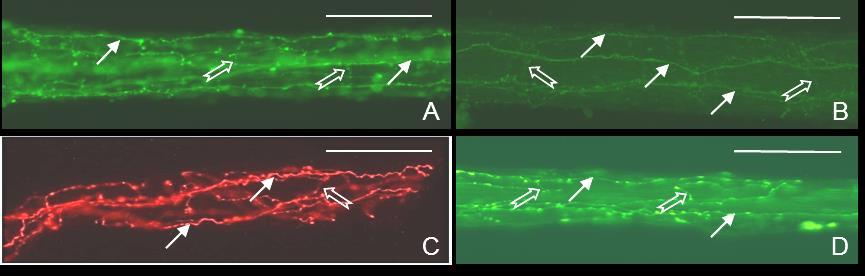 Az FM-ek hossztengelyében végigfutó axonok innervációs mintázatának vizsgálatára elvégeztük az izmok szaglóideg felőli anterográd neurobiotin jelölését is.