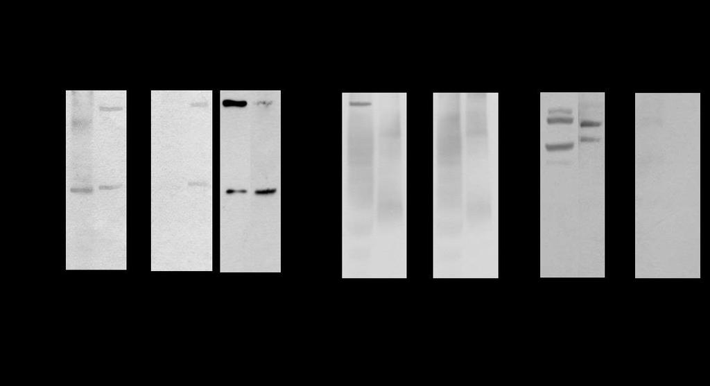 22. ábra Az nachr α4 és α7 alegységeinek kimutatása Western blot módszerrel a KIR-ből, FM-ből és CM-ből származó mintákban.