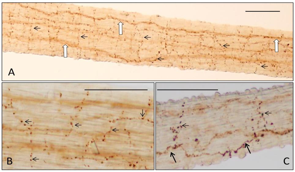 C - Az izomban hosszanti irányban végigfutó vékony varikózus axonok is megfigyelhetőek (nyílhegyek). Arányméret: 50 µm. 31. ábra PAC1 receptor (PAC1R) immunjelölés az FM-ben.