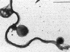 LYME 1. M.O-I BORRELIA ALTÖRZSEK 2. A LYME DIAGNÓZISÁNAK PILLÉREI 3.