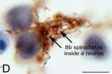 negatív a teszt még akkor is, ha van bennünk borrelia ellenanyag A BORRELIA