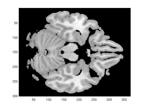 figure(1); imagesc(szelet); colormap gray; % adatok