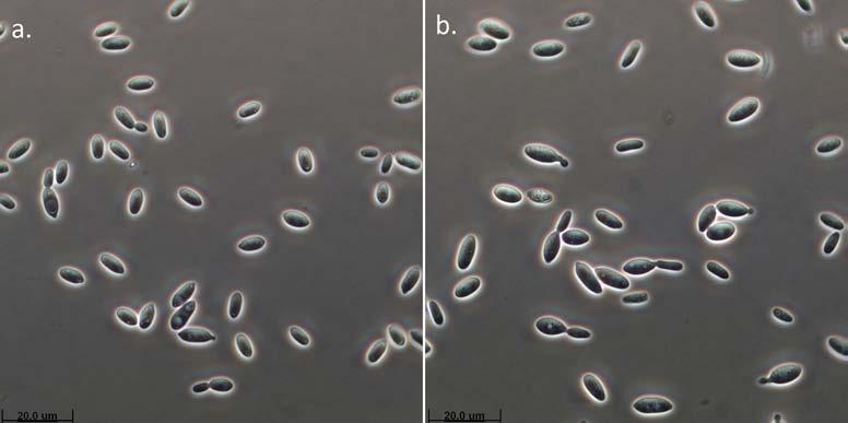 Colonies of 11-1083 on YPG-agar after 5 days at room