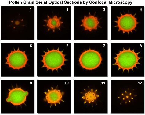 medulla nyúl izom pollen Konfokális mikroszkóp Tubulin