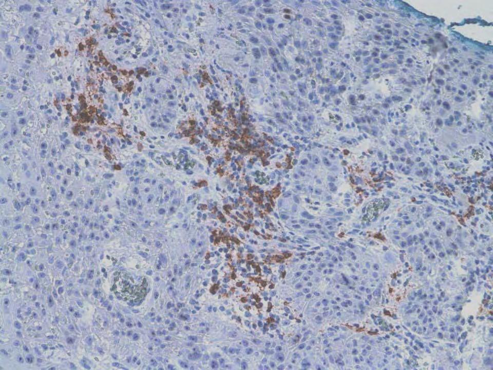 Tumor Immunológia Tímár József Semmelweis Egyetem (SE) 2.sz.