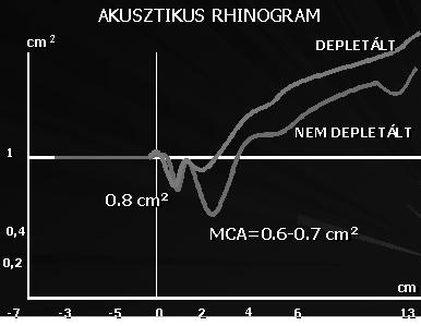 pont közötti térség volumene (cm 3 ) (Hirschberg A. 2004; Hirschberg A. és Rezek 1998). Ezen vizsgáló eljárások objektívek és reprodukálhatók.