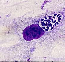 DINOZOA ALTÖZS AHOVÁ SOROLT PÁNCÉLOS OSTOROSOK (DINOFLAGELLATA) TARTOZNAK, VALAMINT A SPÓRÁS EGYSEJTŰEK (CSÚCSSZERVES