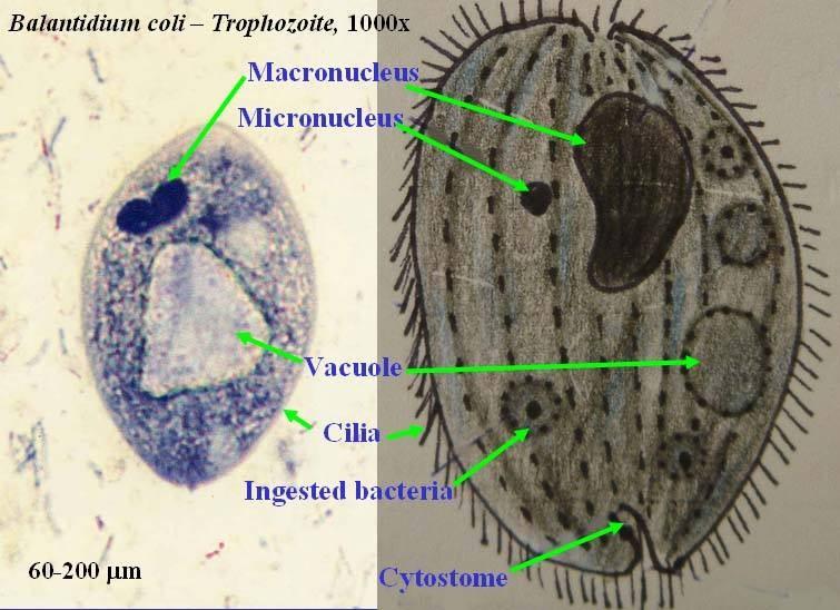 ALVEOLATA TÖRZS: CILIOPHORA