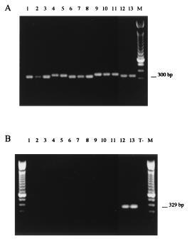 P58SL és P28SL primerek (A) 1, F. moniliforme IP 1579.85; 2, F. moniliforme IP 233.95; 3, F. solani IP 2330.95; 4, F. solani IP 2447.97; 5, F. solani IP 2451.98; 6, F. oxysporum 9582; 7, F.