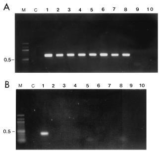 Penicillium marneffei molekuláris diagnosztikája Nested PCR Fajspecifikus hibridizációs próba a 18S rdns primerekkel amplifikált szakaszára (Vanittanakom és mtsai.