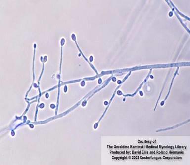 Scedosporium spp. (S. prolificans, S.