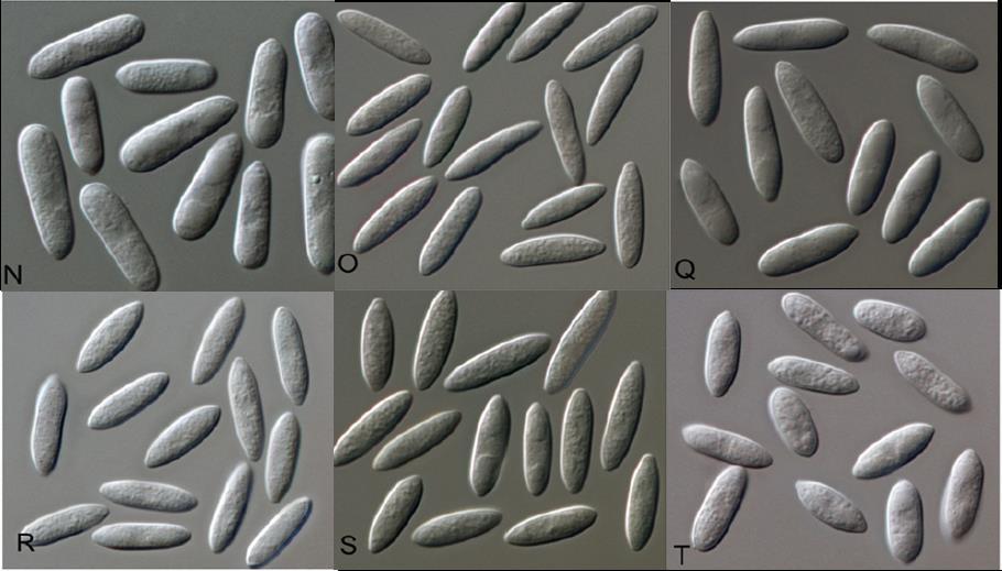 és a konídiumokat hosszúság, átmérő, szín, elágazódás, alak, barázdáltság, stb.