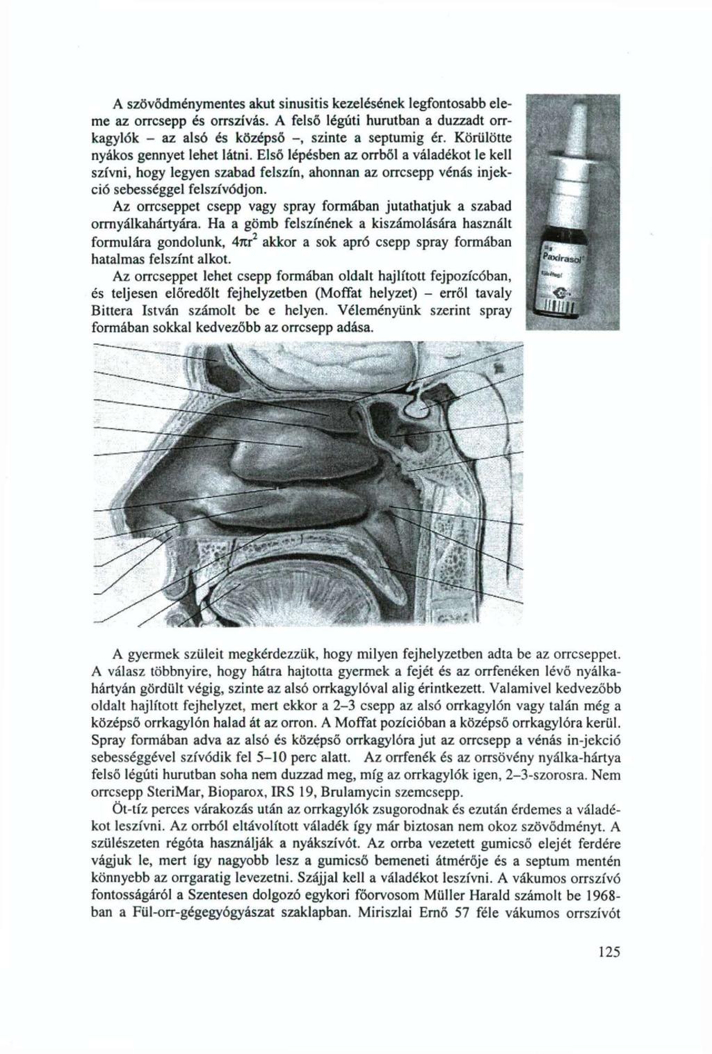 A szövődménymentes akut sinusitis kezelésének legfontosabb eleme az orrcsepp és orrszívás. A felső légúti hurutban a duzzadt orrkagylók - az alsó és középső szinte a septumig ér.