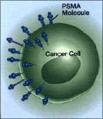 A tumor-markerek alkalmazásának irányelvei BOKOR KÁROLY klinikai