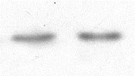 Western blot analízis, carotis WKY Kontroll FGY120 FGY400 P-Akt Ser473 P-GSK-3β Ser9 Actin ** 16.ábra: FGY-1153 hatása az Akt/GSK-3β szignalizációs kaszkádra a carotis falban.