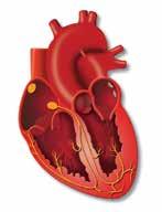 A szívelégtelenség A szívelégtelenség olyan állapot, amikor a szív nem képes megfelelô mennyiségû vért pumpálni a szervezete ellátásához.